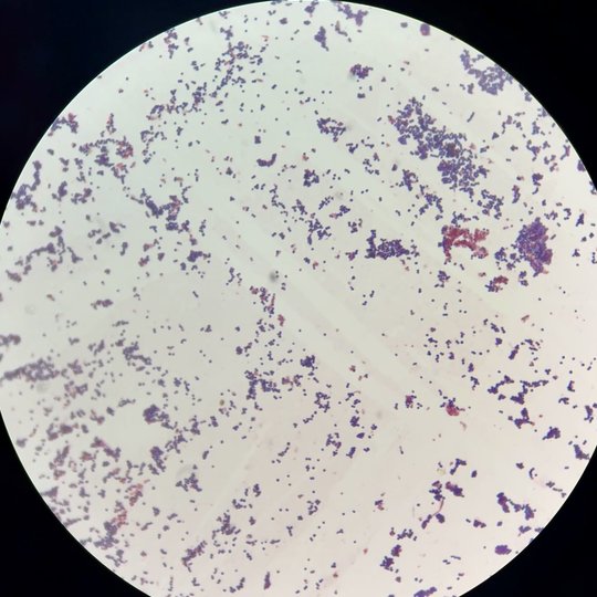 Iliustracija
